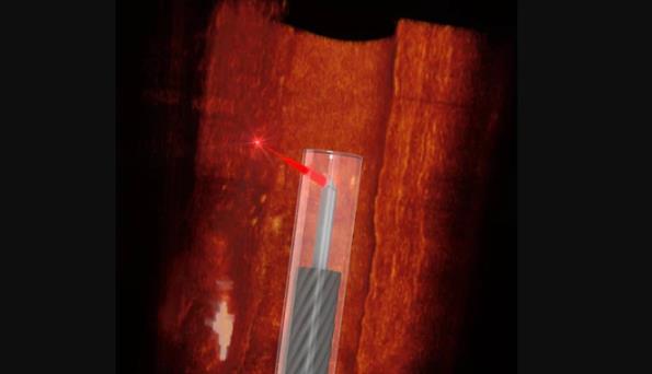  使用3D微型打印技術(shù)開發(fā)了 上 小的靈活血管內(nèi)窺鏡
